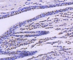 Invitrogen SMC1 Recombinant Rabbit Monoclonal Antibody (SN20-27) 100 &mu;L;