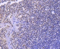 Invitrogen SMC1 Recombinant Rabbit Monoclonal Antibody (SN20-27) 100 &mu;L;