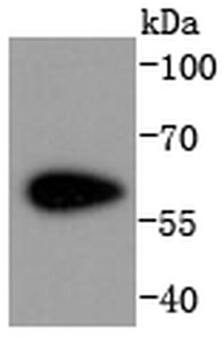 Invitrogen CDK8 Recombinant Rabbit Monoclonal Antibody (SN2030) 100 &mu;L;