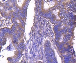 Invitrogen ARF1 Recombinant Rabbit Monoclonal Antibody (SD2002) 100 &mu;L;