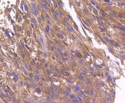 Invitrogen ARF1 Recombinant Rabbit Monoclonal Antibody (SD2002) 100 &mu;L;