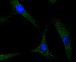 Invitrogen S100A4 Recombinant Rabbit Monoclonal Antibody (SD200-08) 100
