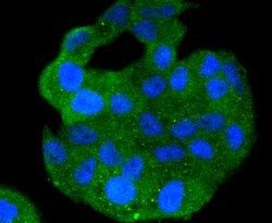 Invitrogen S100A4 Recombinant Rabbit Monoclonal Antibody (SD200-08) 100