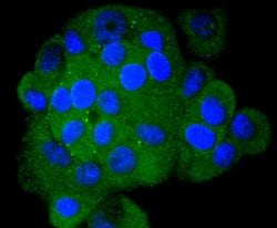 Invitrogen S100A4 Recombinant Rabbit Monoclonal Antibody (SD200-08) 100