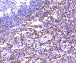Invitrogen S100A4 Recombinant Rabbit Monoclonal Antibody (SD200-08) 100