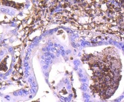 Invitrogen S100A4 Recombinant Rabbit Monoclonal Antibody (SD200-08) 100