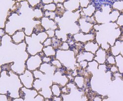 Invitrogen S100A4 Recombinant Rabbit Monoclonal Antibody (SD200-08) 100