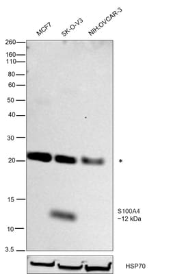Invitrogen S100A4 Recombinant Rabbit Monoclonal Antibody (SD200-08) 100