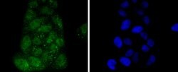 Invitrogen IRF3 Recombinant Rabbit Monoclonal Antibody (SD2062) 100 &mu;L;