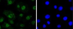 Invitrogen RelB Recombinant Rabbit Monoclonal Antibody (SD07-39) 100 &mu;L;