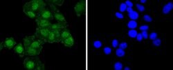 Invitrogen RelB Recombinant Rabbit Monoclonal Antibody (SD07-39) 100 &mu;L;
