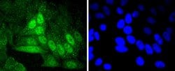 Invitrogen Cyclin A2 Recombinant Rabbit Monoclonal Antibody (SD2052) 100
