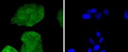 Invitrogen CDK6 Recombinant Rabbit Monoclonal Antibody (SD20-50) 100 &mu;L;