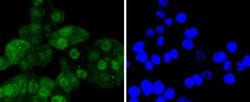 Invitrogen CDK6 Recombinant Rabbit Monoclonal Antibody (SD20-50) 100 &mu;L;