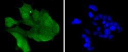 Invitrogen CDK6 Recombinant Rabbit Monoclonal Antibody (SD20-50) 100 &mu;L;