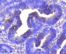 Invitrogen CDK6 Recombinant Rabbit Monoclonal Antibody (SD20-50) 100 &mu;L;