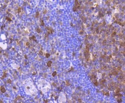 Invitrogen CDK6 Recombinant Rabbit Monoclonal Antibody (SD20-50) 100 &mu;L;
