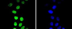 Invitrogen Phospho-Cyclin E (Thr77) Recombinant Rabbit Monoclonal Antibody