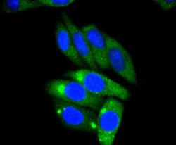 Invitrogen AP2M1 Recombinant Rabbit Monoclonal Antibody (SD0746) 100 &mu;L;