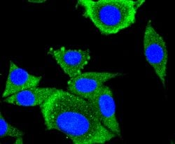 Invitrogen AP2M1 Recombinant Rabbit Monoclonal Antibody (SD0746) 100 &mu;L;