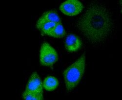 Invitrogen AP2M1 Recombinant Rabbit Monoclonal Antibody (SD0746) 100 &mu;L;