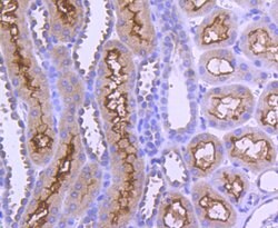 Invitrogen AP2M1 Recombinant Rabbit Monoclonal Antibody (SD0746) 100 &mu;L;