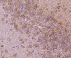 Invitrogen AP2M1 Recombinant Rabbit Monoclonal Antibody (SD0746) 100 &mu;L;