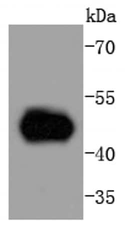 Invitrogen MEK5 Recombinant Rabbit Monoclonal Antibody (SD208-6) 100 &mu;L;