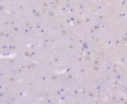 Invitrogen MKK7 Recombinant Rabbit Monoclonal Antibody (SD20-87) 100 &mu;L;