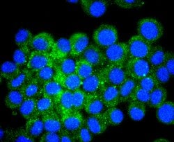Invitrogen ATF4 Recombinant Rabbit Monoclonal Antibody (SD20-92) 100 &mu;L;