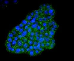 Invitrogen ATF4 Recombinant Rabbit Monoclonal Antibody (SD20-92) 100 &mu;L;