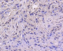 Invitrogen ATF4 Recombinant Rabbit Monoclonal Antibody (SD20-92) 100 &mu;L;