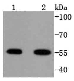 Invitrogen ATF4 Recombinant Rabbit Monoclonal Antibody (SD20-92) 100 &mu;L;
