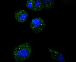 Invitrogen ATF5 Recombinant Rabbit Monoclonal Antibody (SD2099) 100 &mu;L;