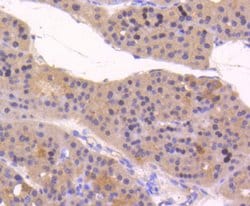 Invitrogen ATF5 Recombinant Rabbit Monoclonal Antibody (SD2099) 100 &mu;L;