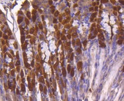 Invitrogen ATF5 Recombinant Rabbit Monoclonal Antibody (SD2099) 100 &mu;L;