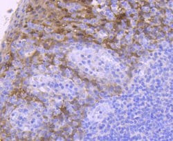 Invitrogen 14-3-3 sigma Recombinant Rabbit Monoclonal Antibody (SD2070)