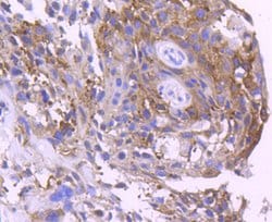 Invitrogen 14-3-3 sigma Recombinant Rabbit Monoclonal Antibody (SD2070)