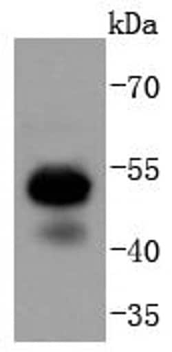 Invitrogen RUNX1/RUNX2/RUNX3 Recombinant Rabbit Monoclonal Antibody (SD0803)