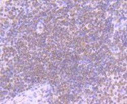 Invitrogen STIM1 Recombinant Rabbit Monoclonal Antibody (SD0814) 100 &mu;L | Buy Online | Invitrogen&trade; | Fisher Scientific