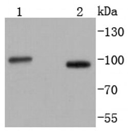 Invitrogen STIM1 Recombinant Rabbit Monoclonal Antibody (SD0814) 100 &mu;L | Buy Online | Invitrogen&trade; | Fisher Scientific