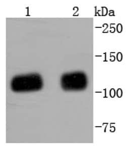 Invitrogen TRIM28 Recombinant Rabbit Monoclonal Antibody (SD081-05) 100 &mu;L | Buy Online | Invitrogen&trade; | Fisher Scientific