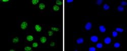 Invitrogen PAX8 Recombinant Rabbit Monoclonal Antibody (SD0832) 100 &mu;L;