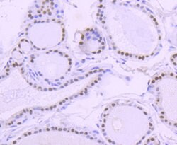 Invitrogen PAX8 Recombinant Rabbit Monoclonal Antibody (SD0832) 100 &mu;L;