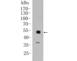 Invitrogen PAX8 Recombinant Rabbit Monoclonal Antibody (SD0832) 100 &mu;L;