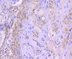 Invitrogen FOXO4 Recombinant Rabbit Monoclonal Antibody (SD0817) 100 &mu;L;