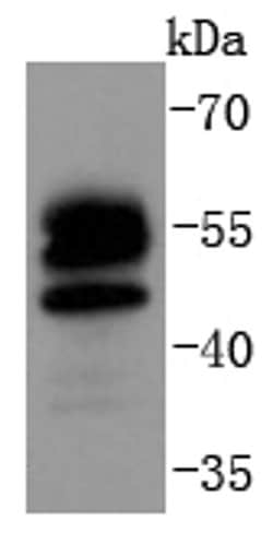 Invitrogen FOXO4 Recombinant Rabbit Monoclonal Antibody (SD0817) 100 &mu;L;