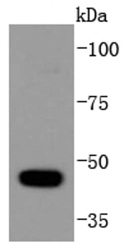 Invitrogen HDAC10 Recombinant Rabbit Monoclonal Antibody (SD08-11) 100