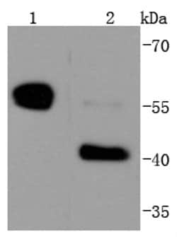 Invitrogen Caspase 8 Recombinant Rabbit Monoclonal Antibody (SD08-06) 100