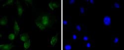 Invitrogen SOX11 Recombinant Rabbit Monoclonal Antibody (SD203-08) 100